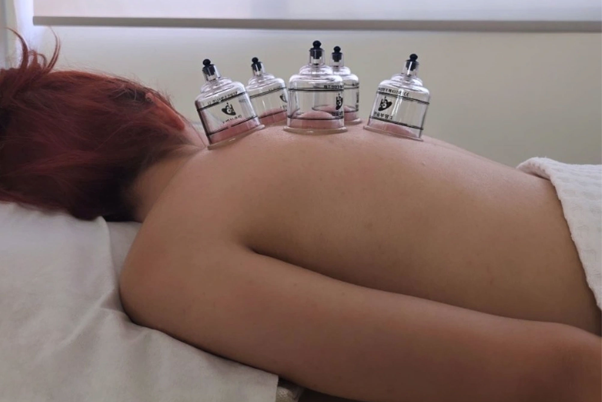 Βεντούζες στο Ελληνικό – Reflexology Touch